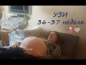 37 неделя вторая беременность