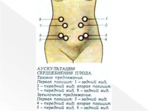 Можно ли услышать сердцебиение плода в домашних условиях
