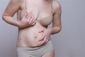 Почему после родов обвисает грудь