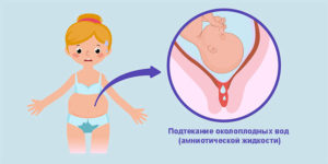 Могут ли воды подтекать на 15 неделе беременности