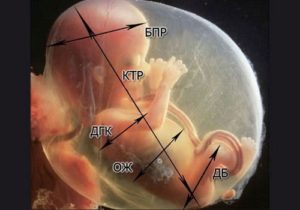 Что такое окружность головы плода