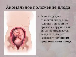 Почему ребенок лежит поперек