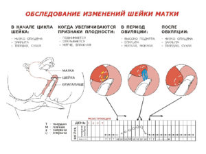 Положение матки после зачатия