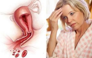 Менструация в период менопаузы