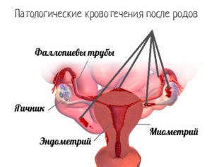 Кровянистые выделения после удаления матки через год