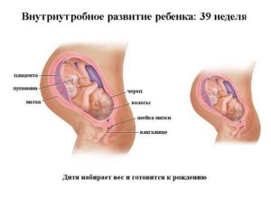 Боли как при месячных на 38 неделе беременности