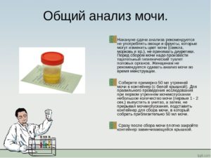 Что нельзя пить и есть перед сдачей мочи