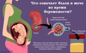 Нашли белок в моче при беременности что делать