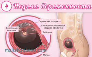 Признаки на 4 недели беременности