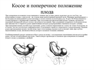 Поперечное положение плода причины