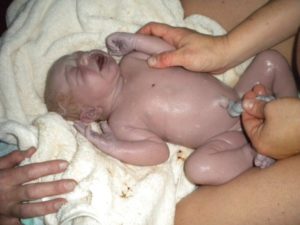 Последствия обвития пуповиной для ребенка после родов
