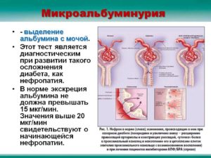 Повышен микроальбумин в моче