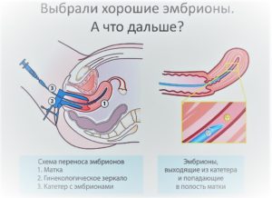 Питание эмбриона после переноса