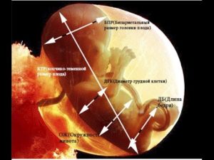 Что такое окружность головы плода