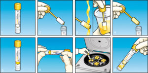 Как правильно сдать мочу на посев при беременности
