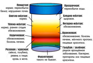 Почему у ребенка коричневая моча