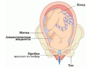 Околоплодные воды как отходят воды