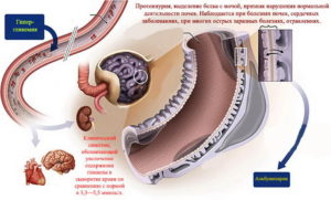 Нашли белок в моче при беременности что делать