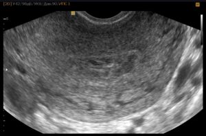Можно ли делать узи в 2 недели беременности