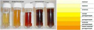 При беременности моча красноватая