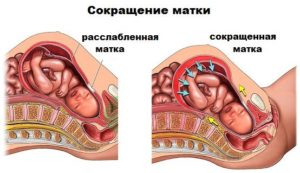 Тонус матки что вызывает