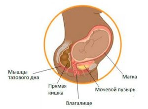 Мочевой пузырь после родов ослаб