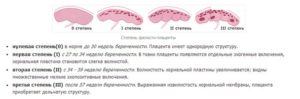 Толщина плаценты норма 31 неделя