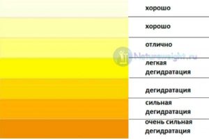 У ребенка моча темно желтая