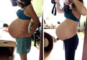 Почему не опускается живот на 40 неделе беременности