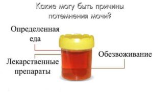 У ребенка темная моча утром