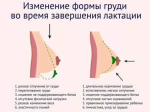 Почему грудь после родов обвисает