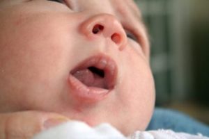 У новорожденного на губе мозоль