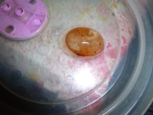 Как выглядит околоплодное яйцо