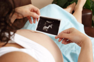 На каком сроке делают последнее узи при беременности