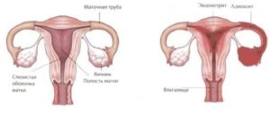 Задержка месячных при аднексите