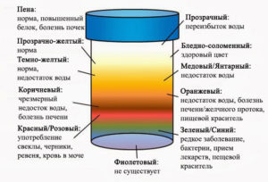 У ребенка моча темно желтая