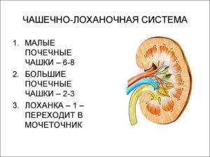 При беременности расширение лоханки