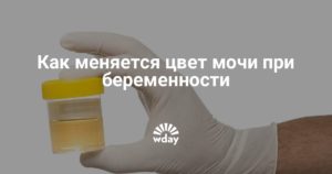 Моча при беременности на ранних сроках какого цвета