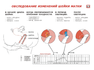 Матка опускается при беременности