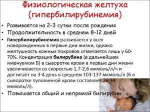 Желтушка у новорожденных сколько длится