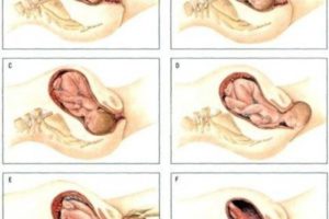 Что сделать чтобы матка быстрее открылась при родах