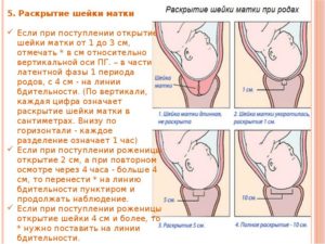 На сколько пальцев должна раскрыться матка при родах