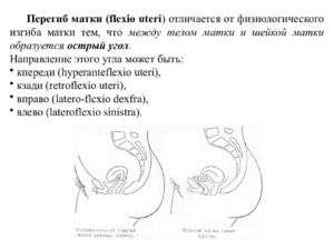 Положение матки после зачатия