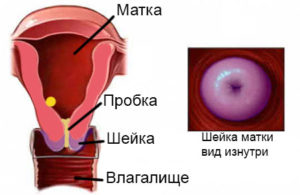 При беременности цвет шейки матки