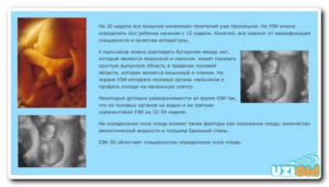 На каком месяце виден пол ребенка на узи