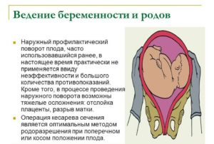 Поперечное положение плода причины