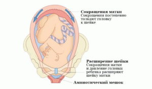 Матка при беременности сокращается