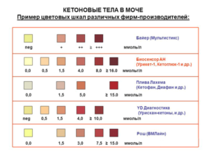 Кетоны в моче при беременности на ранних сроках