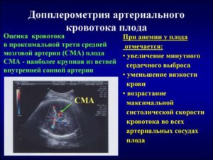 Узи при беременности кровотока