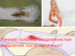 Почему менструация идет долго